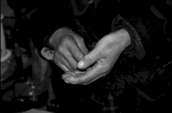 不只手抖！72歲帕金森患者重度憂鬱臥床不語　靠磁刺激治療重拾笑容